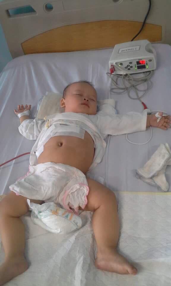 xót thương tiếng khoc của bé 10 tháng bị u nguyên bào gan, cuộc sống như ngọn đèn trước gió