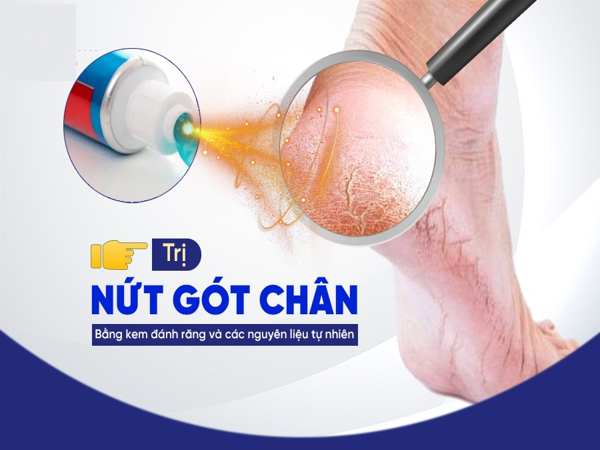 Chăm sóc da chân – giải pháp đơn giản tại gia