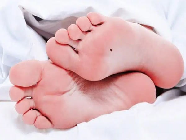 Nốt ruồi ở lòng bàn chân nữ giới – vận số ra sao?