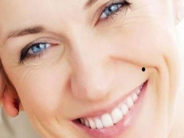 Nốt ruồi rãnh cười ở nữ giới