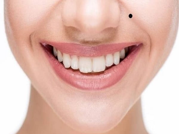 Ý nghĩa chung của nốt ruồi rãnh cười